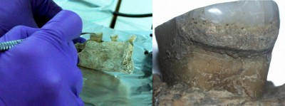 Figure 6. Sampling dental calculus from Vlasac (new excavations) (left); detail of calculus preserved on Mesolithic individual from the same site (right); photographs by E. Cristiani. 